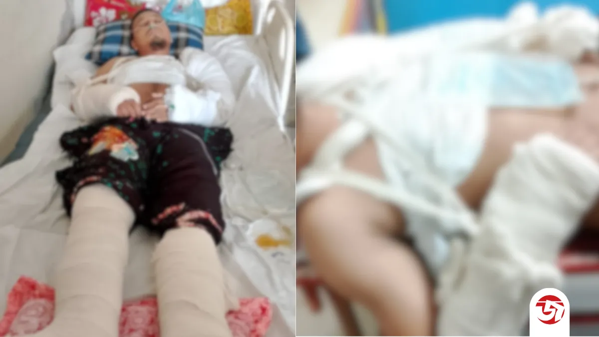 শ্বশুরবাড়িতে মারধরের পর পাঁচতলা থেকে ফেলে দেওয়ার অভিযোগ, জাবি কর্মচারী হাসপাতালে