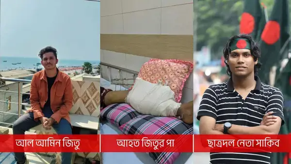 ছাত্রদল নেতার সহায়তায় পা হারানো থেকে বাঁচলো ঢাবি শিক্ষার্থী