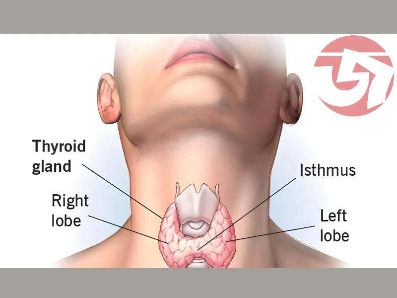 থাইরয়েড কী ও করণীয়