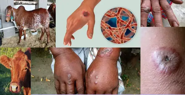 রংপুর অঞ্চলে অ্যানথ্রাক্স প্রতিরোধে প্রাণিসম্পদ অধিদপ্তরের কার্যক্রম শুরু