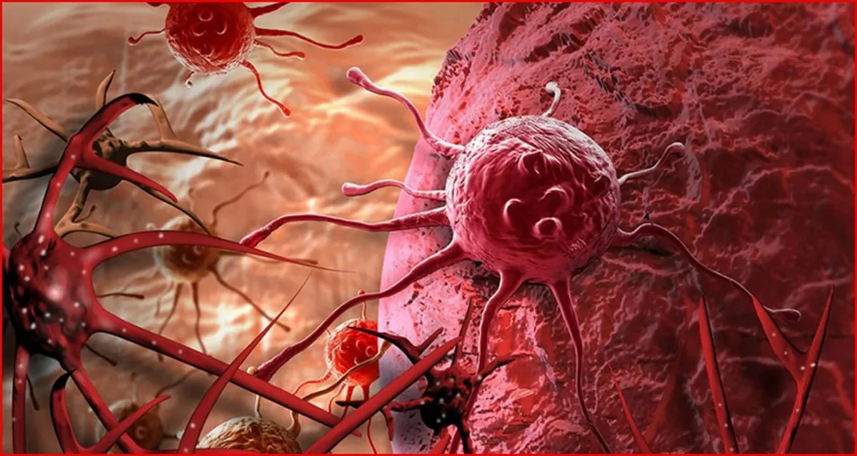 লক্ষণ দেখানোর পাঁচ বছর পূর্বেই ক্যানসার শনাক্ত করবে এআই!