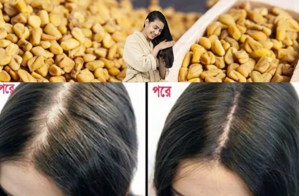 চুল পড়া থেকে শীতল মাথা,এক মুঠোতেই প্রকৃতির নিঃশব্দ চিকিৎসা!