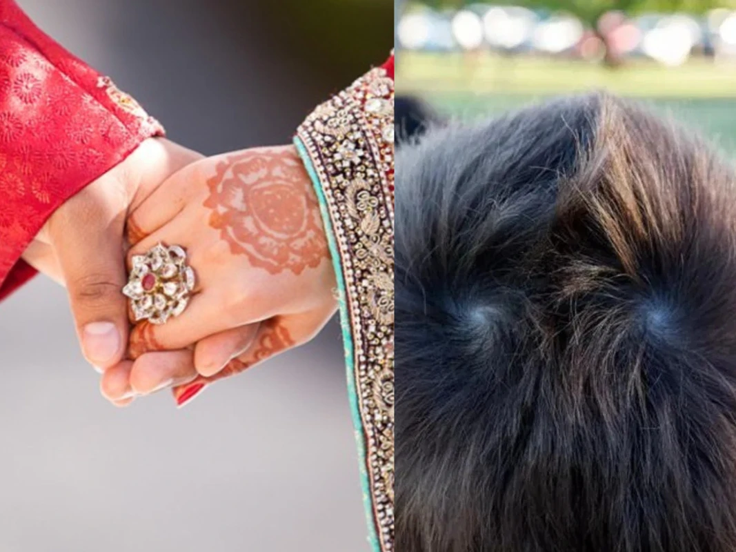 মাথার চুলের পাক বলে দেবে, কয়টা বিয়ে আপনার ভাগ্যে!