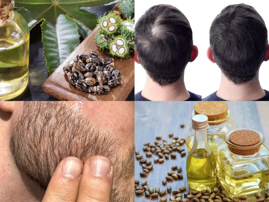 এক তেলে দুই কাজ! চুলের ঘনত্ব আর দাড়ির স্টাইল দুটোই ফিরিয়ে আনবে এই প্রাকৃতিক উপায়