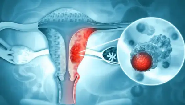 চিকিৎসকেরা বলছেন, এই একটি ভুলেই বাড়ছে নারীদের মৃত্যুঝুঁকি!