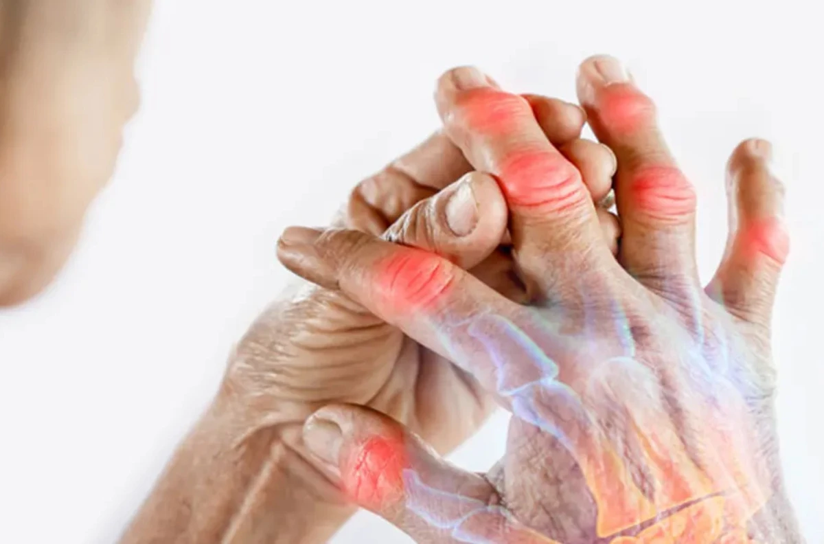 হাত-পা অচেতন, ত্বক জ্বালা, খোঁচা-নিউরোপ্যাথির যে  সংকেতগুলো কখনো এড়িয়ে যাওয়া যাবে না!