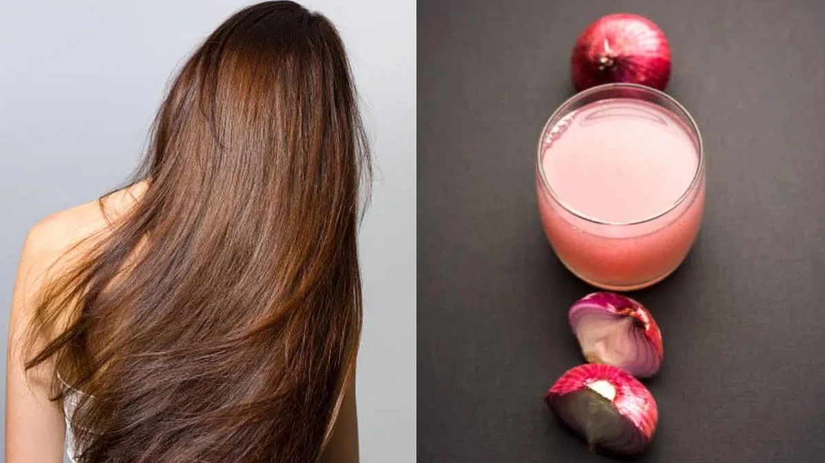 চুল পড়া কমাতে পেঁয়াজের রস ব্যবহার করুন, ফলাফল দেখুন মাত্র কয়েক সপ্তাহে!