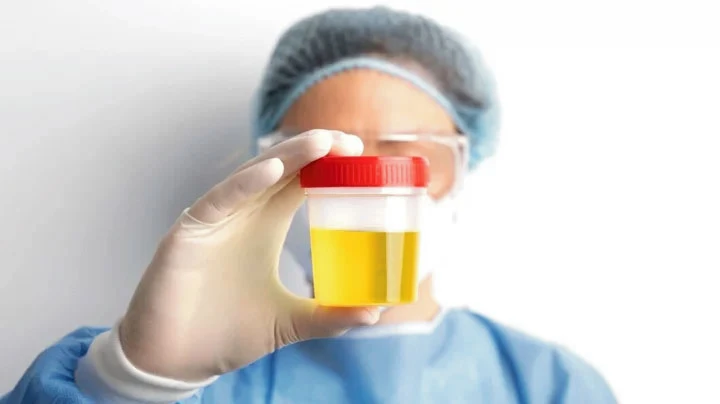 নারীর প্রস্রাবের ইনফেকশন হলে করণীয়