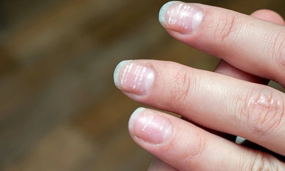 শরীরে জিংকের কাজ কী? ঘাটতি পূরণে যা করবেন